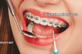 Diş Teli Maliyeti 2025