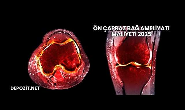 Ön Çapraz Bağ Ameliyatı Maliyeti 2025