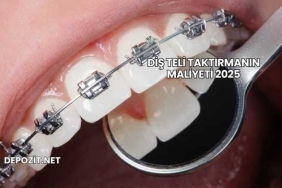Diş Teli Taktırmanın Maliyeti 2025